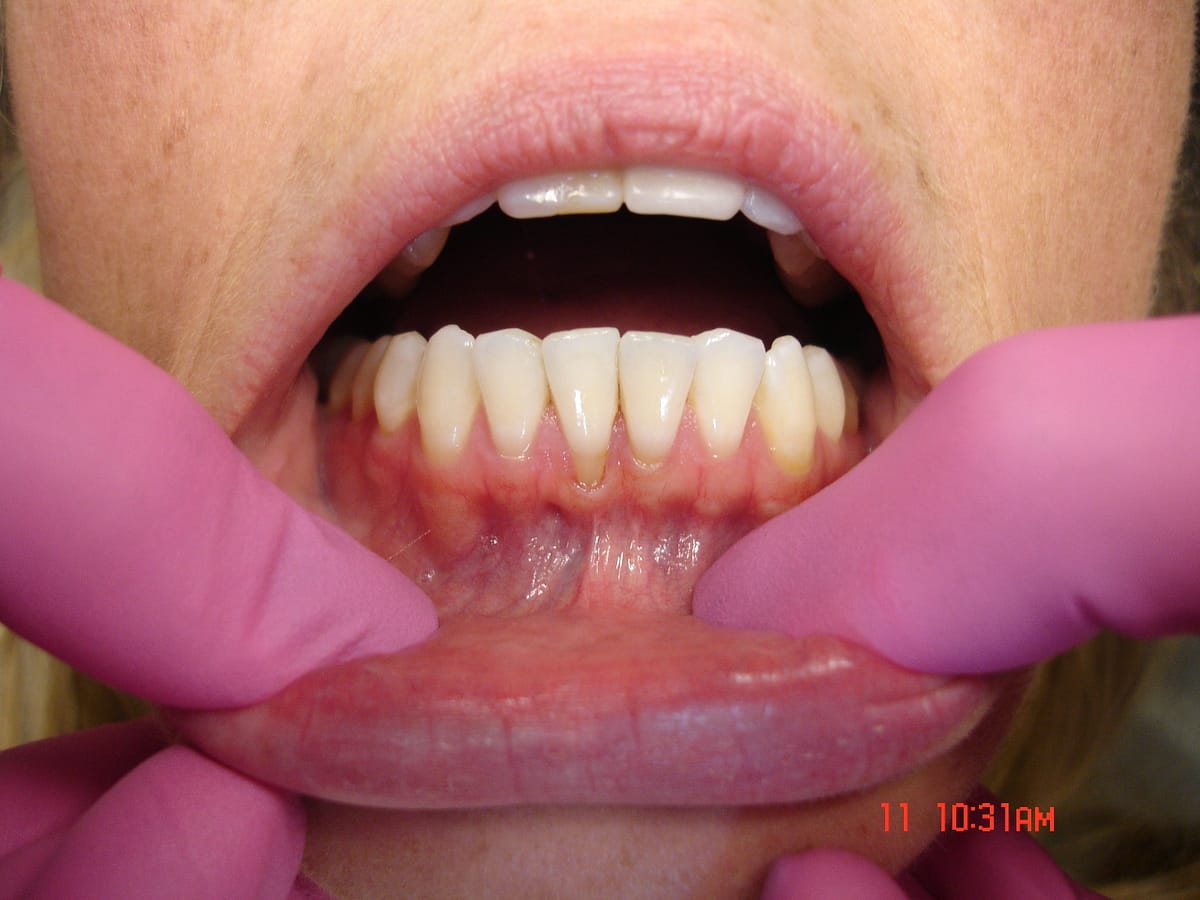 displaying bottom teeth