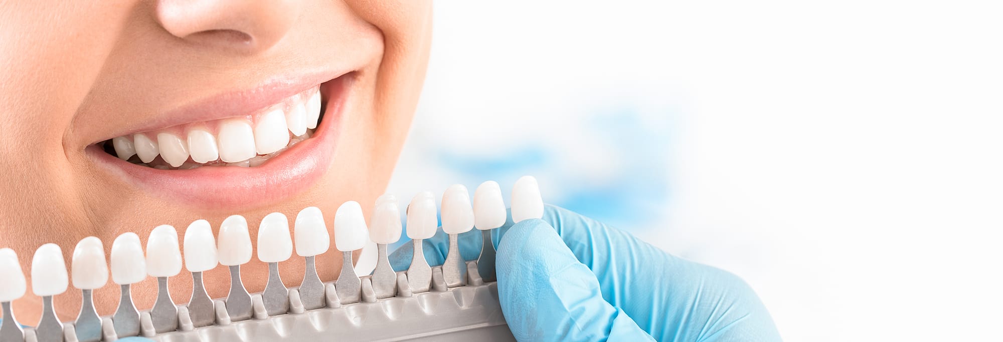 How Long Can Teeth Implant Last? Dental Offices Near Me