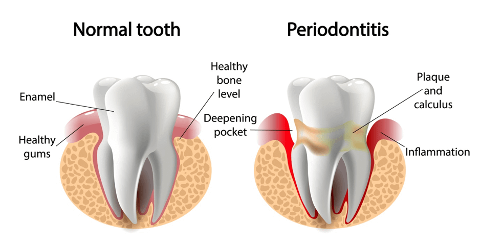 What Type of Procedures Do Periodontists Perform?