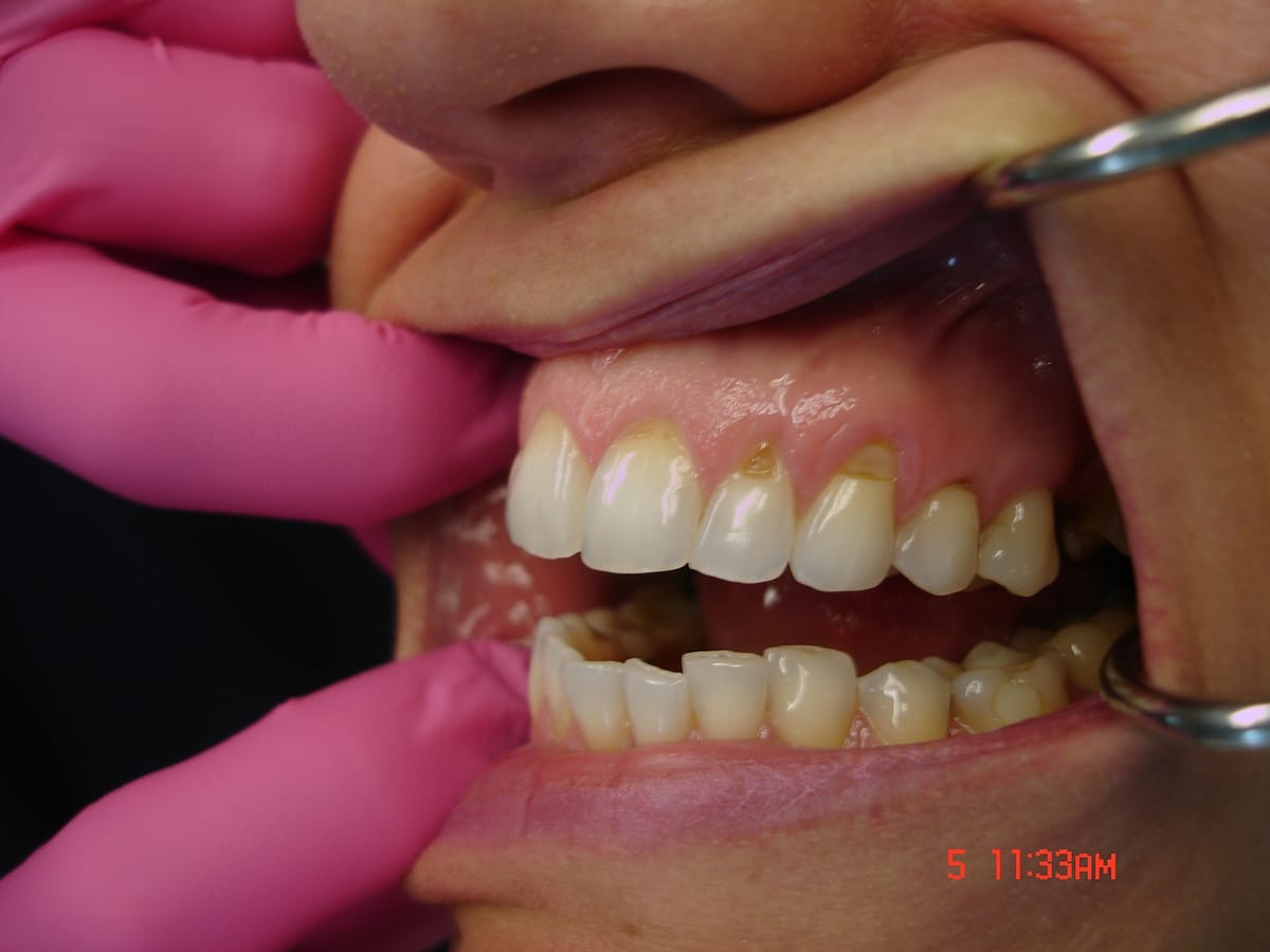 dentist holding mouth open
