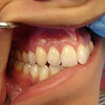 dentist holding mouth open after surgery