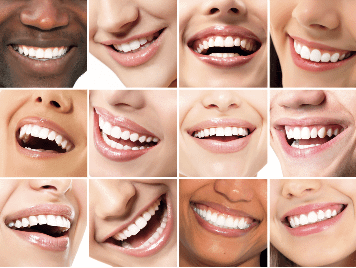 multiple teeth profiles